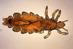 pediculus_humanus_var_capitis